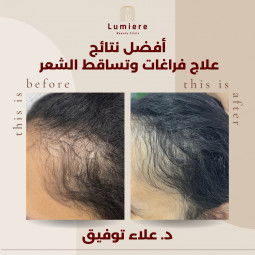 Jobs and Careers at lumiere clinics in Egypt | join today!